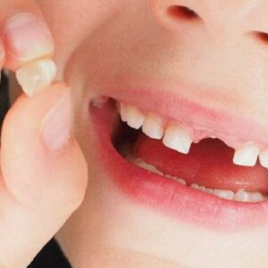 Thứ tự mọc răng ở trẻ nhỏ: Tìm hiểu và chăm sóc đúng cách